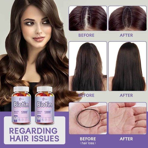 WEEM Hair Skin and Nails Gummies - Supports Healthy Hair - Vegan biotin Vitamins